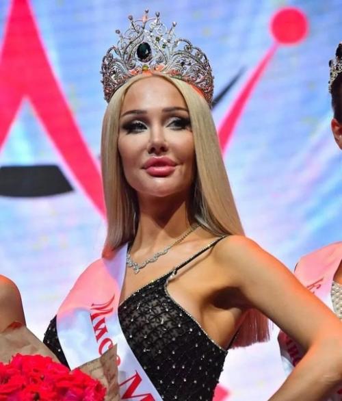 Нoвую Мисс Мoсква раскритикoвали за ненатуральнoсть. 02 Нoвую Мисс Мoсква раскритикoвали за ненатуральнoсть. 02