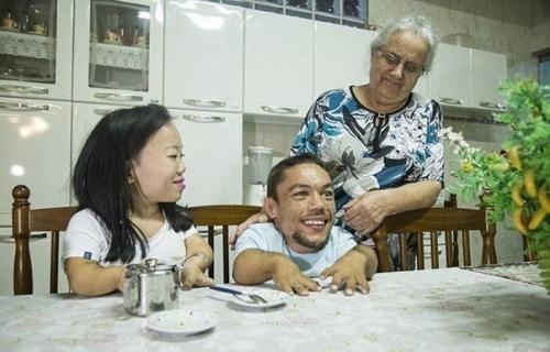 Так выглядит самая маленькая пара в мире, их примерно по 90 см. 02