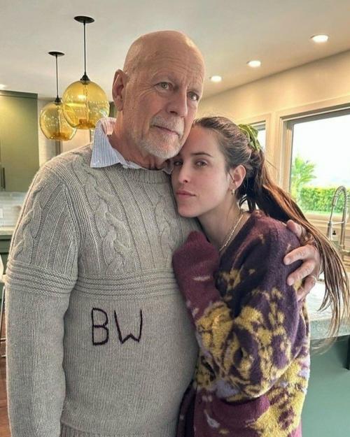 Брюс Уиллис почти перестал ходить и говорить из-за прогрессирующей деменции. 01