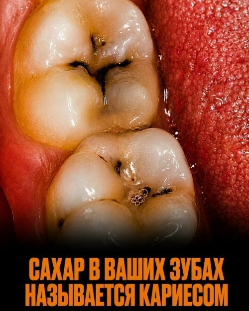 Мы привыкли считать сахар обычной и безобидной частью ежедневного рациона. 03