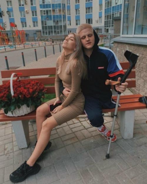 Девушка не бросила его, когда он потерял ногу в аварии. 01