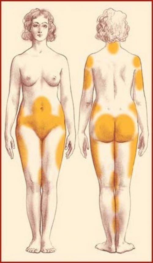 Антицеллюлитный баночный массаж - просто и эффективно! 