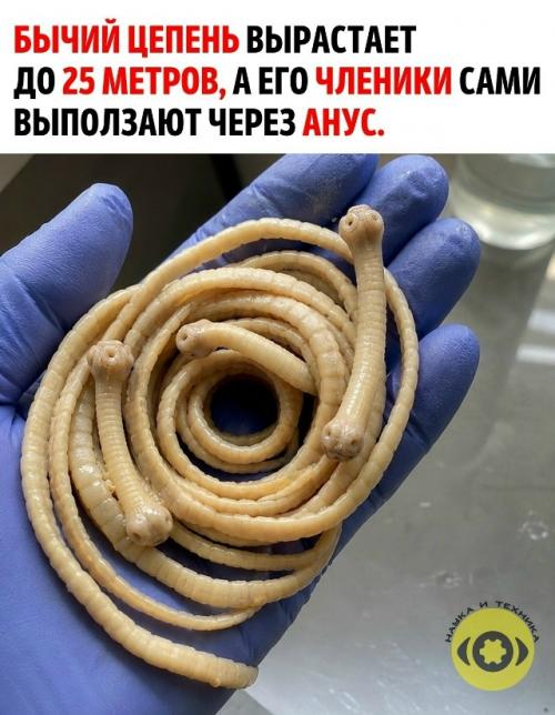 Этот паразит цепляется присосками за тонкий кишечник и месяцами или годами может почти никак себя не выдавать.  