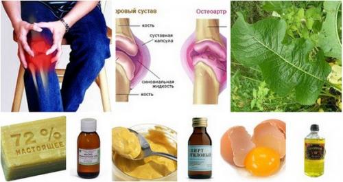 Болят колени, лечение народными средствами. Болят колени, лечение народными средствами.
